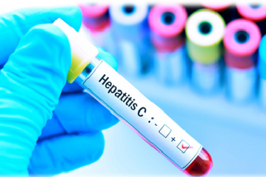 prueba de la hepatitis c