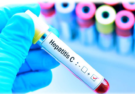 prueba de la hepatitis c