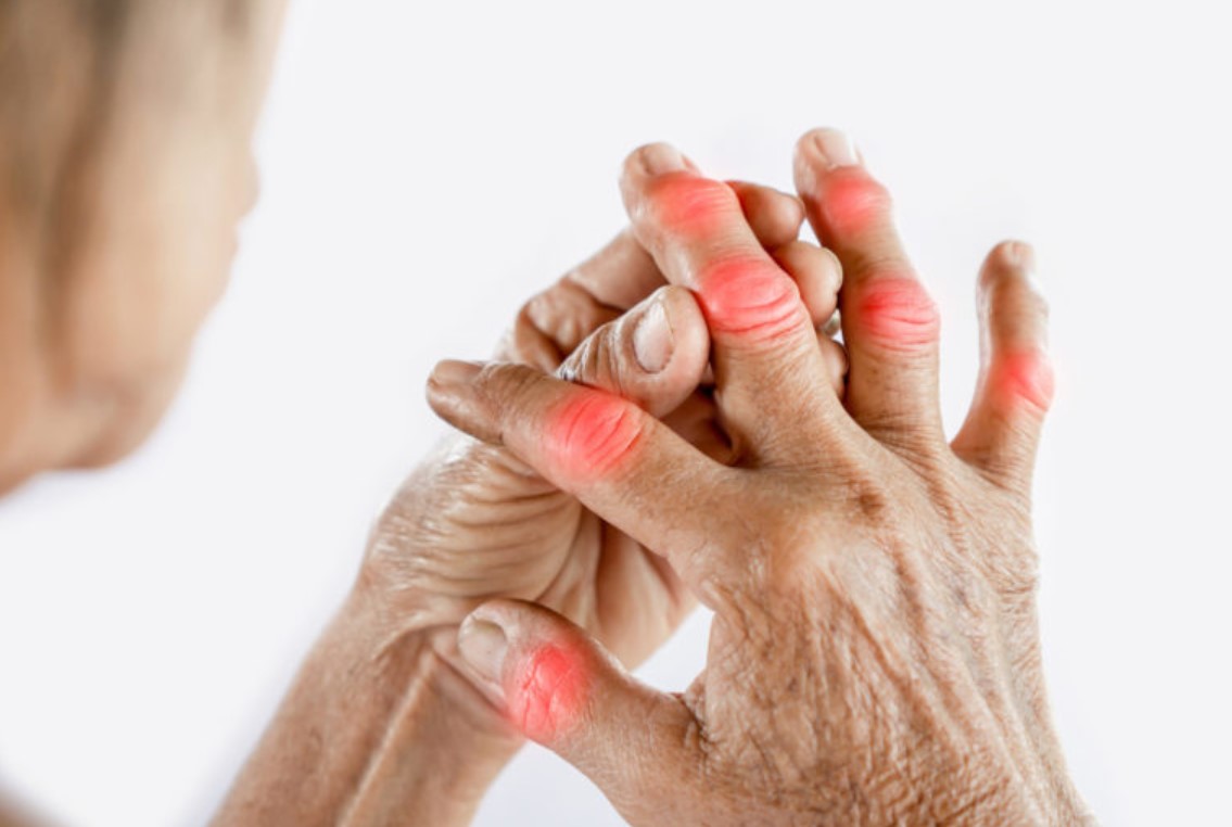 Qué es la artritis