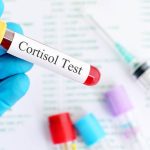 Reducir el cortisol