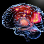 epilepsia causas y tratamientos