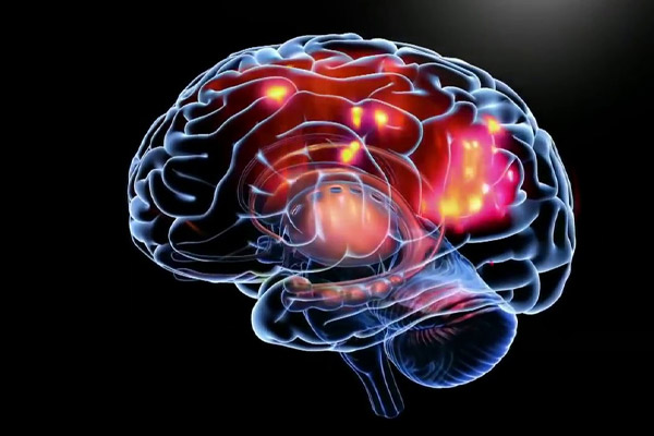 epilepsia causas y tratamientos