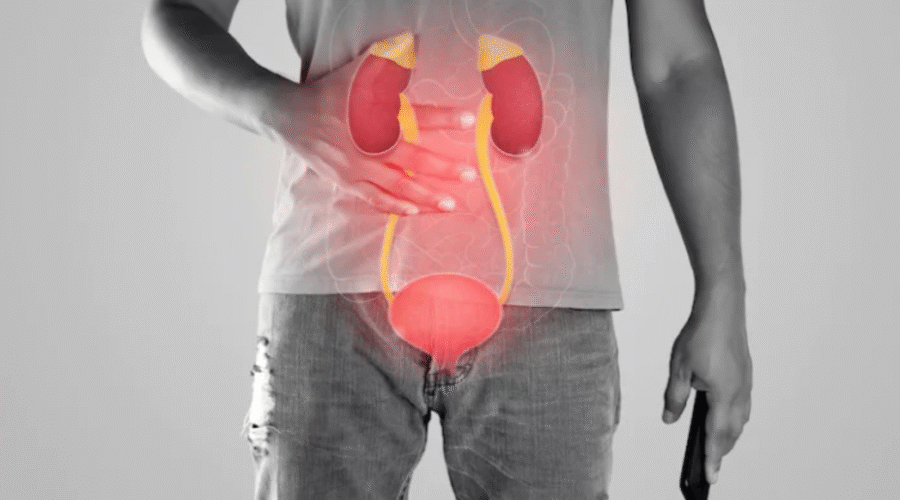 hombre con diagrama de sistema urinario