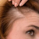 mujer con caida de cabello