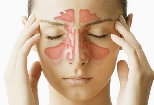 aliviar la congestión nasal